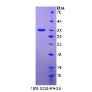 Human Amyloid Beta Precursor Protein Binding Protein A2 (APBA2) Protein