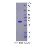 Human Interleukin 36 Alpha (IL36A) Protein