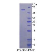 Mouse P-Selectin Glycoprotein Ligand 1 (PSGL1) Protein