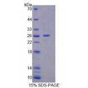 Rat Interleukin 17D (IL17D) Protein
