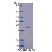 Rat Interleukin 36 Gamma / IL1F9 (IL36G) Protein