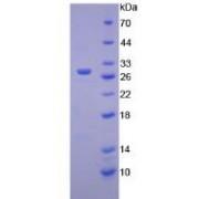 Mouse Hexosaminidase A Alpha (HEXa) Protein (Active)