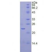 Rat Sirtuin 3 (SIRT3) Protein (Active)