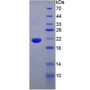 Mouse Tumor Necrosis Factor (TNF) Protein (Active)
