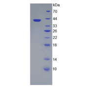 Mouse Heparan Sulfate Proteoglycan 2 (HSPG2) Protein
