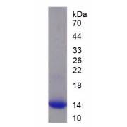 Human Retinoid X Receptor Alpha (RXRa) Protein