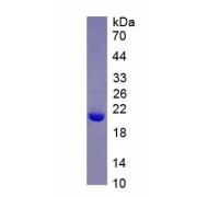 Rat Interleukin 1 Beta (IL1b) Protein (Active)
