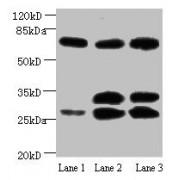 Beta-Amyloid Precursor Protein (APP) Antibody
