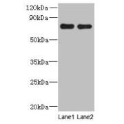 Actin-Related Protein 8 (ACTR8) Antibody