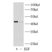 Transcription Factor Jun Phospho-Ser73 (Jun pS73) Antibody