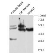 Fibroblast Growth Factor Receptor 1 (FGFR1) Antibody