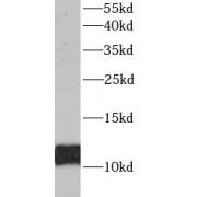 Acylphosphatase 1 (ACYP1) Antibody