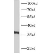 Adenosine A1 Receptor (ADORA1) Antibody