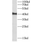 Absent In Melanoma 2 (AIM2) Antibody