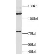 Amyloid Beta Precursor Like Protein 2 (APLP2) Antibody