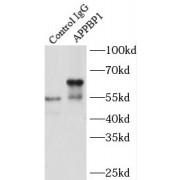 Amyloid Beta Precursor Protein Binding Protein 1 (APPBP1) Antibody