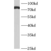 DCC-Interacting Protein 13-Alpha (APPL1) Antibody
