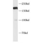 AT-Rich Interactive Domain-Containing Protein 4B (ARID4B) Antibody
