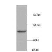 Breast Cancer Type 1 Susceptibility Protein (BRCA1) Antibody