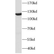 Damage Specific DNA Binding Protein 1 (DDB1) Antibody