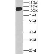 DENN Domain Containing Protein 1A (DENND1A) Antibody