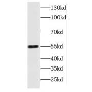 Docking Protein 2 (DOK2) Antibody