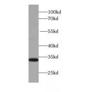 Interleukin-28A (IL-28A) Antibody
