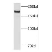 Kalirin (KALRN) Antibody