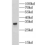 Leucine Rich Repeat Containing Protein 10 (LRRC10) Antibody