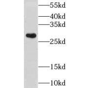 Leucine Rich Repeat Containing Protein 18 (LRRC18) Antibody