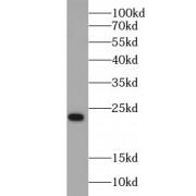 Pre-IL18 Antibody