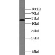 Retinoid X Receptor Alpha (RXRA) Antibody