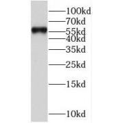 Serpin D1 (SERPIND1) Antibody