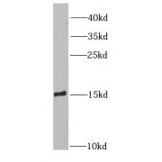 SH2 Domain Containing 1A (SH2D1A) Antibody