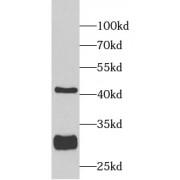 Sirtuin 3 (SIRT3) Antibody