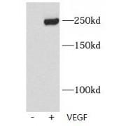 Kinase Insert Domain Receptor Phospho-Tyr1175 (KDR pY1175) Antibody