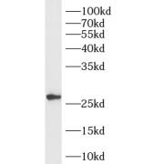 Ras-related protein Rab-33B (RAB33B) Antibody
