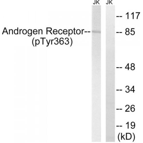 Androgen Receptor (Phospho-Tyr363) Antibody