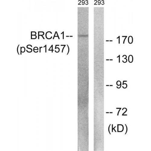 Breast Cancer Type 1 Susceptibility Protein Phospho-Ser1457 (BRCA1 pS1457) Antibody