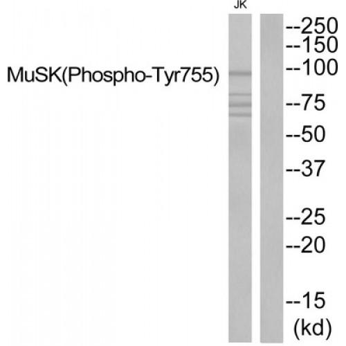 Muscle Skeletal Receptor Tyrosine Kinase Phospho-Tyr755 (MUSK pY755) Antibody