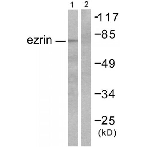 Ezrin (EZR) Antibody