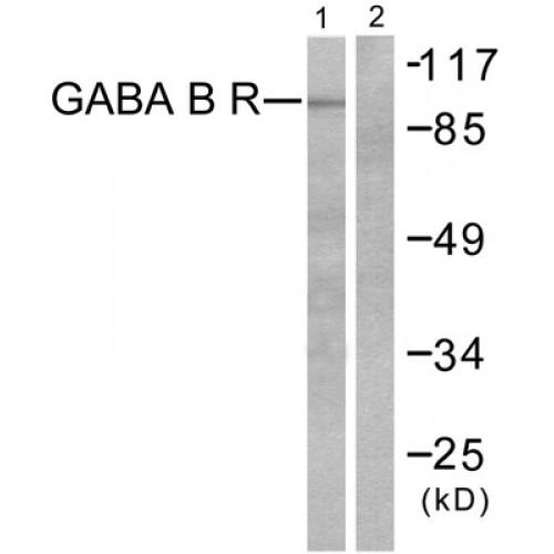 Gamma-Aminobutyric Acid Type B Receptor Subunit 1 (GABBR1) Antibody
