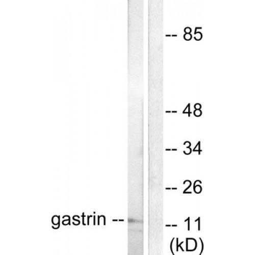 Gastrin (GAST) Antibody