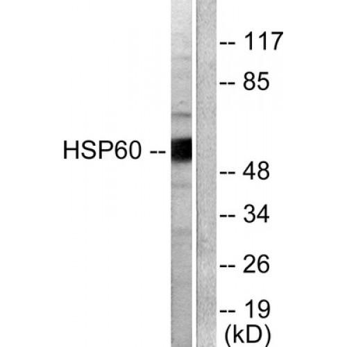 Heat Shock 60 kDa Protein 1, Chaperonin / HSP60 (HSPD1) Antibody