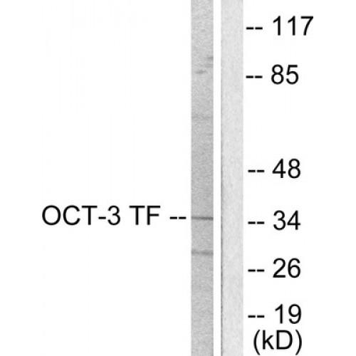 Octamer-Binding Protein 3 (POU5F1) Antibody