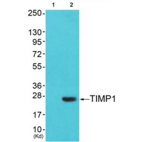 Metalloproteinase Inhibitor 1 (TIMP1) Antibody