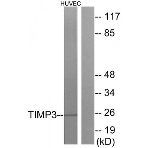Metalloproteinase Inhibitor 3 (TIMP3) Antibody