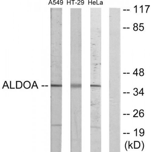 Fructose-Bisphosphate Aldolase A (ALDOA) Antibody