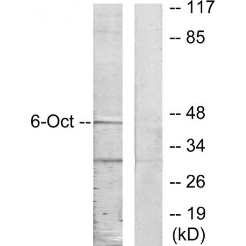 POU Class 3 Homeobox 1 / OCT6 (POU3F1) Antibody