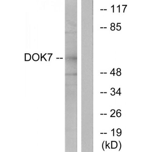 Protein Dok-7 (DOK7) Antibody